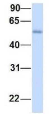 Western Blot: ME2 Antibody [NBP1-54765]