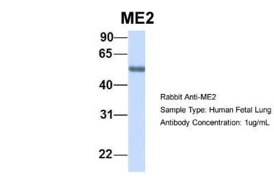 Western Blot: ME2 Antibody [NBP1-54765]