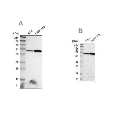 Western Blot: ME2 Antibody [NBP1-82434]