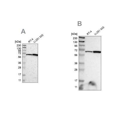 Western Blot: ME2 Antibody [NBP1-89559]