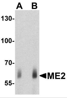 Western Blot: ME2 AntibodyBSA Free [NBP2-82105]