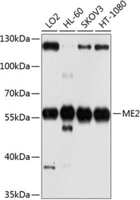 Western Blot: ME2 AntibodyBSA Free [NBP3-04862]