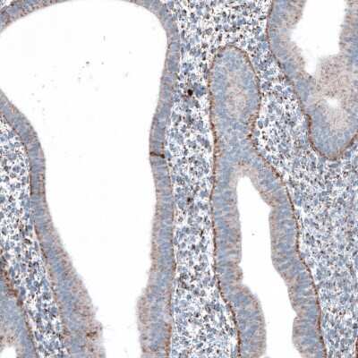 Immunohistochemistry-Paraffin: ME3 Antibody [NBP1-85871]