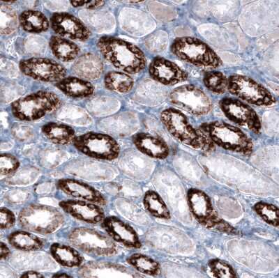 Immunohistochemistry-Paraffin: ME3 Antibody [NBP1-85871]