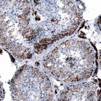Immunohistochemistry-Paraffin: ME3 Antibody [NBP1-85871]