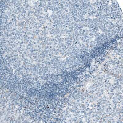Immunohistochemistry-Paraffin: ME3 Antibody [NBP1-85871]