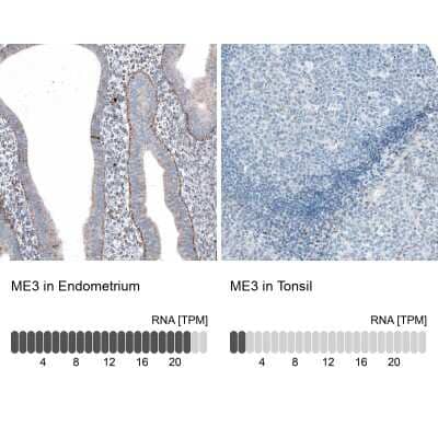 Immunohistochemistry-Paraffin: ME3 Antibody [NBP1-85871]