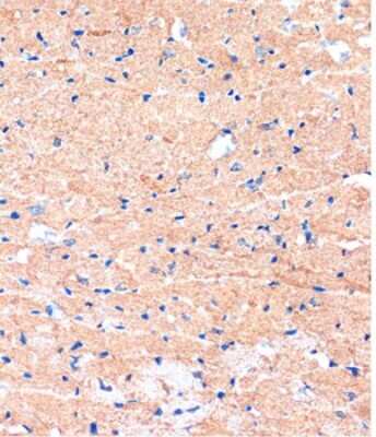 Immunohistochemistry-Paraffin: ME3 Antibody - Azide and BSA Free [NBP3-05078]