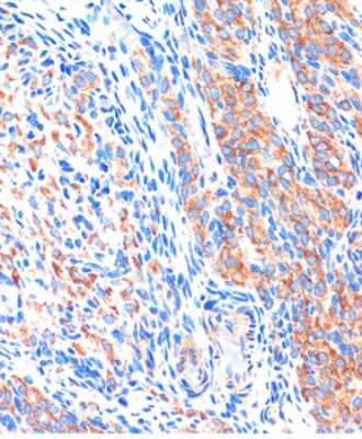 Immunohistochemistry-Paraffin: ME3 Antibody - Azide and BSA Free [NBP3-05078]