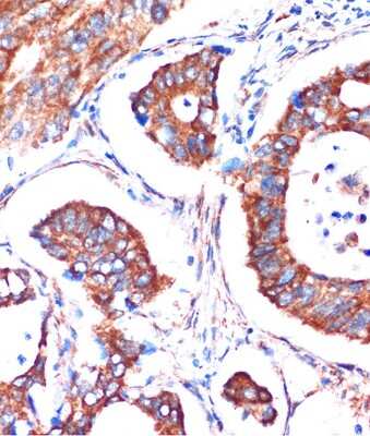 Immunohistochemistry-Paraffin: ME3 Antibody - Azide and BSA Free [NBP3-05078]