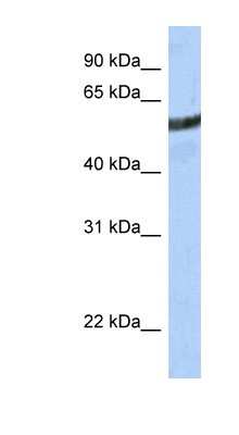 Western Blot: ME3 Antibody [NBP1-54755]