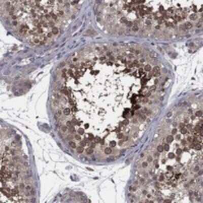 Immunohistochemistry-Paraffin: MEA-1 Antibody [NBP3-17392]