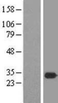 Western Blot: MEA-1 Overexpression Lysate [NBL1-12976]