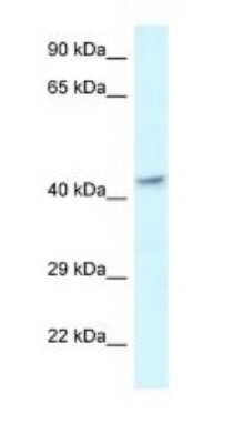 Western Blot: MECR Antibody [NBP1-79910]