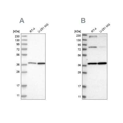 Western Blot: MECR Antibody [NBP1-85657]