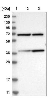 Western Blot: MECR Antibody [NBP1-85658]