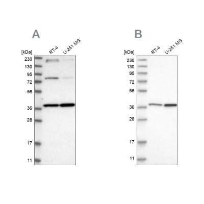 Western Blot: MECR Antibody [NBP1-85659]