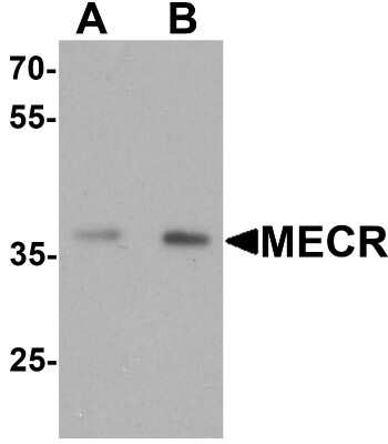 Western Blot: MECR AntibodyBSA Free [NBP2-81846]