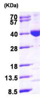 Western Blot: Recombinant Human MECR His Protein [NBP1-45272]