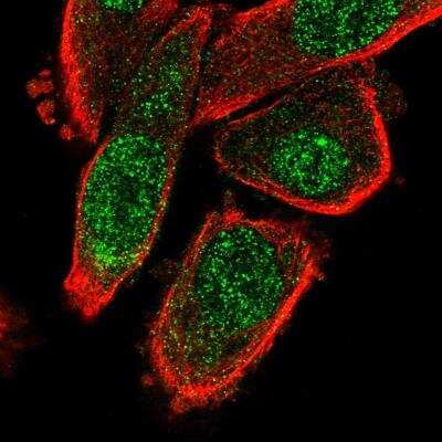 Immunocytochemistry/ Immunofluorescence: MED10 Antibody [NBP1-81328]