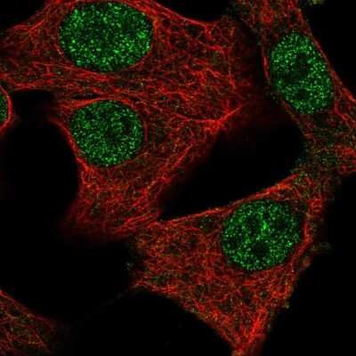 Immunocytochemistry/ Immunofluorescence: MED11 Antibody [NBP2-34162]