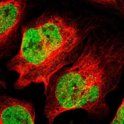 Immunocytochemistry/ Immunofluorescence: MED12 Antibody [NBP1-86669]