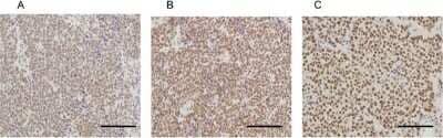 Immunohistochemistry: MED12 Antibody [NB100-2357]