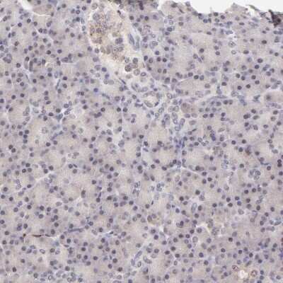 Immunohistochemistry-Paraffin: MED12 Antibody [NBP1-86669]