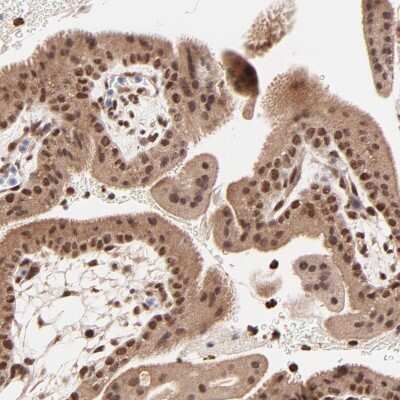 Immunohistochemistry-Paraffin: MED12 Antibody [NBP1-86669]
