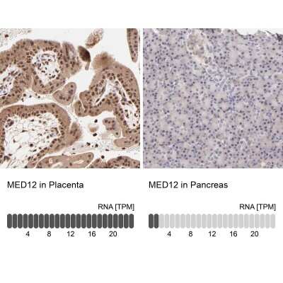 Immunohistochemistry-Paraffin: MED12 Antibody [NBP1-86669]