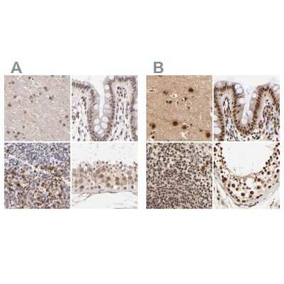 Immunohistochemistry-Paraffin: MED12 Antibody [NBP1-86669]