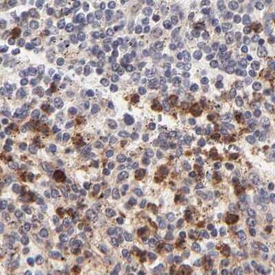 Immunohistochemistry-Paraffin: MED12 Antibody [NBP1-86669]