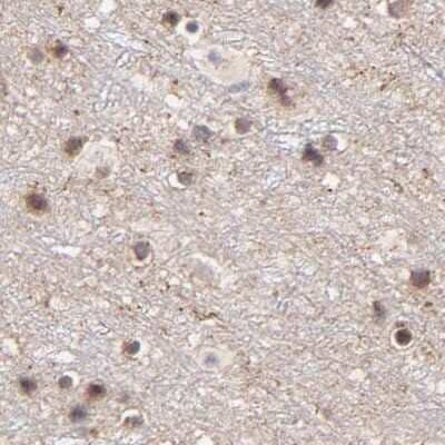 Immunohistochemistry-Paraffin: MED12 Antibody [NBP1-86669]