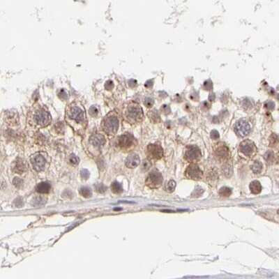 Immunohistochemistry-Paraffin: MED12 Antibody [NBP1-86669]