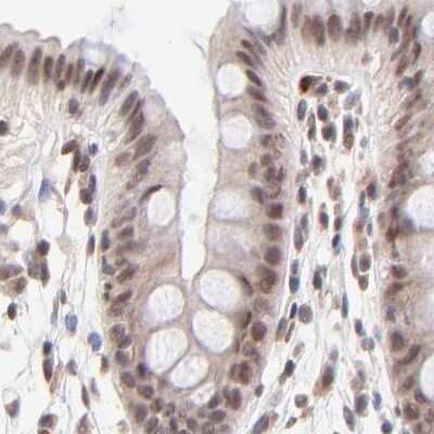 Immunohistochemistry-Paraffin: MED12 Antibody [NBP1-86669]