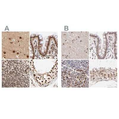 Immunohistochemistry-Paraffin: MED12 Antibody [NBP1-86670]
