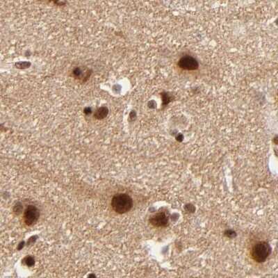 Immunohistochemistry-Paraffin: MED12 Antibody [NBP1-86670]