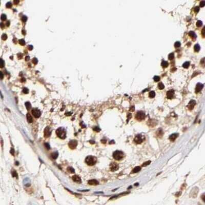 Immunohistochemistry-Paraffin: MED12 Antibody [NBP1-86670]
