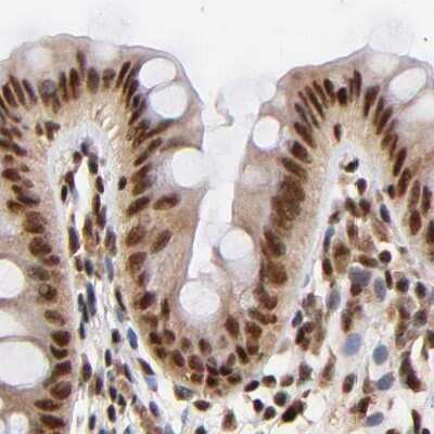 Immunohistochemistry-Paraffin: MED12 Antibody [NBP1-86670]