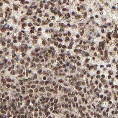Immunohistochemistry-Paraffin: MED12 Antibody [NBP1-86670]