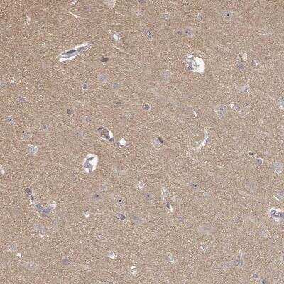 Immunohistochemistry-Paraffin: MED12L Antibody [NBP1-81391]