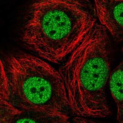 Immunocytochemistry/ Immunofluorescence: MED13 Antibody [NBP2-57545]