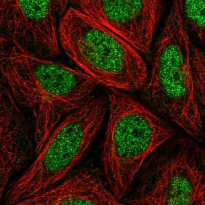 Immunocytochemistry/ Immunofluorescence: MED14 Antibody [NBP2-56318]