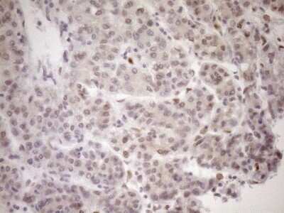 Immunohistochemistry: MED15 Antibody (OTI1C11) [NBP2-45780]