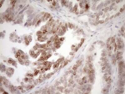 Immunohistochemistry: MED15 Antibody (OTI1C11) [NBP2-45780]