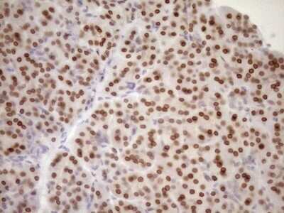 Immunohistochemistry: MED15 Antibody (OTI1C11) [NBP2-45780]