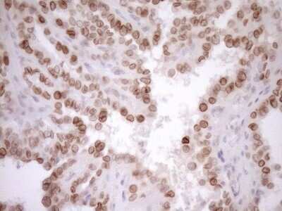 Immunohistochemistry: MED15 Antibody (OTI1C11) [NBP2-45780]