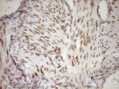 Immunohistochemistry: MED15 Antibody (OTI1C11) [NBP2-45780]