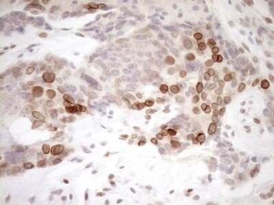 Immunohistochemistry: MED15 Antibody (OTI1C11) [NBP2-45780]