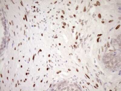Immunohistochemistry: MED15 Antibody (OTI1C11) [NBP2-45780]